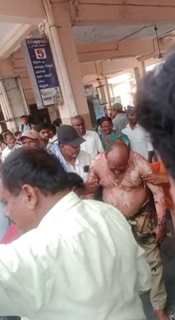 RTC Strike Tragedy: Driver Attempts Suicide in Narsampet by Setting Himself Ablaze Over Unmet Demands
