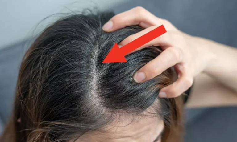 Health Tips: Don’t Leave Wet Hair to Dry on Its Own During Monsoon